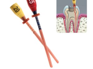 Pacdent Pac-Taper GPC Obturator, Gutter Percha Carrier, 5 x #A1 GPC Obturators + 1 x #20 verifier